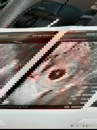 Hamil 8 minggu tapi scan baru 5 minggu