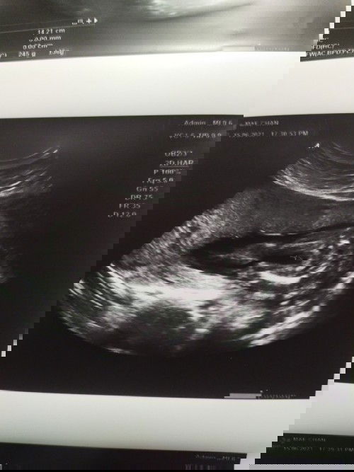 แม่ๆช่วยดูหน่อยจ้า ผช/ผญ