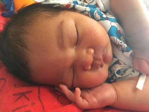 ลูกตัวเหลืองนานมั้ยกว่าจะหาย