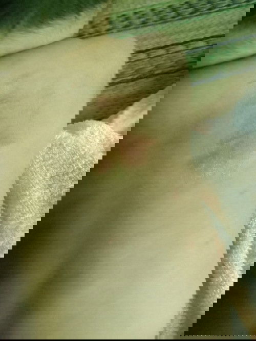 น้องมีตุ่มขึ้นแบบนี้เป็นเพราะอะไรคะ?