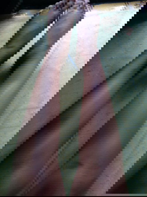 Kaki bengkak setelah melahir kan