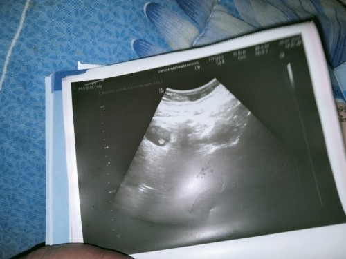 เด็กกี่สัปดาห์