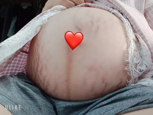 Có mom nào bị rạn như em không nhìn cái bụng mà chán quá 😑😑