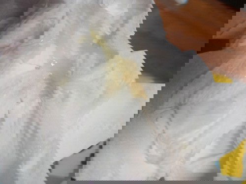 กระตุ้นปากมดลูก