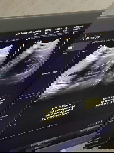 ลุ้นเพศลูกกกกก