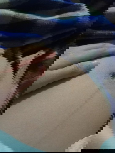 Bakit naninigas na tiyan ko? 35weeks nako pregnant . Hirap na din Ako makatulog .