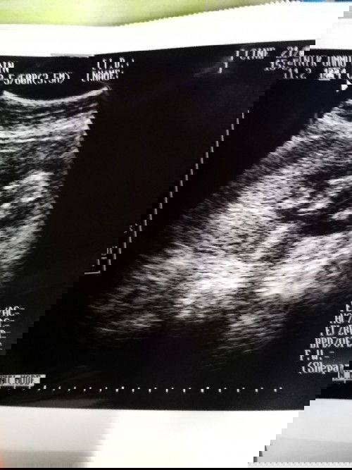 Ada tak mommy preggy bby twin kat sini?? Saya bby dah 14w Twin..share pengalaman boleh?