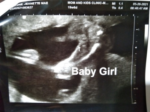 Gender of my baby