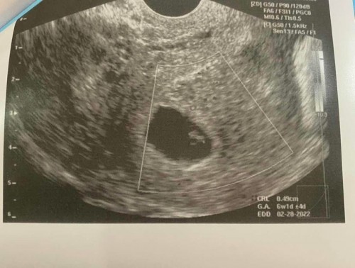 No heartbeat😢