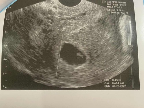 No heartbeat😢😭