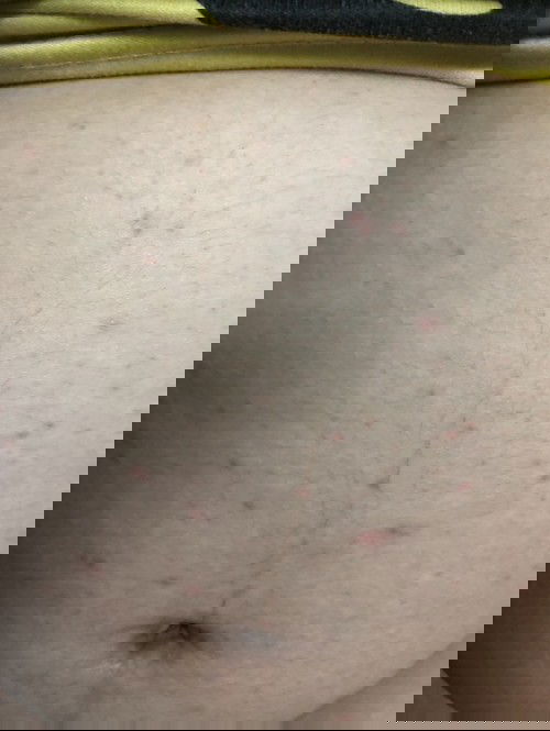 E mag thai được 26w mà bụng bị như thế này có mom nào biết nguyên nhân và chữa sao không ạ