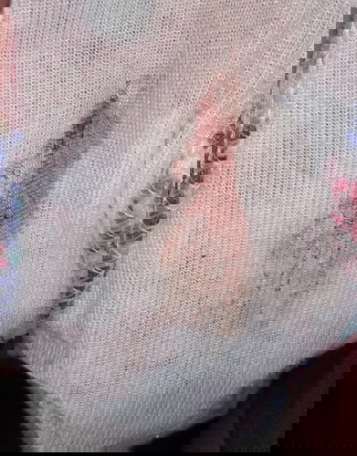 Normal ba mag spotting ang buntis ?