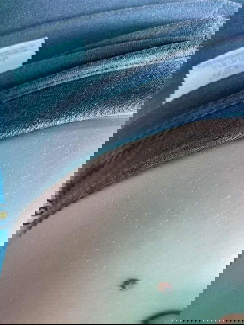 ท้องเป็นขุย ใช้ครีมตัวไหนทาดีค่ะแม่ๆ