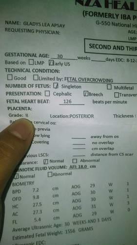 hi po . ano pong ibig sabihin ng "fetal overcrowding" ?