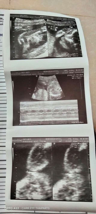 Suddgest naman po kayo Gurl name start with letter A 😍