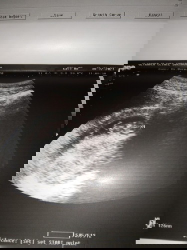 Safe na posisyon po sa paghiga for preggy? Required din po ba ang hilot for preggy?3 mos. at pataas?