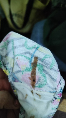 Inplantation bleeding? Or mens?