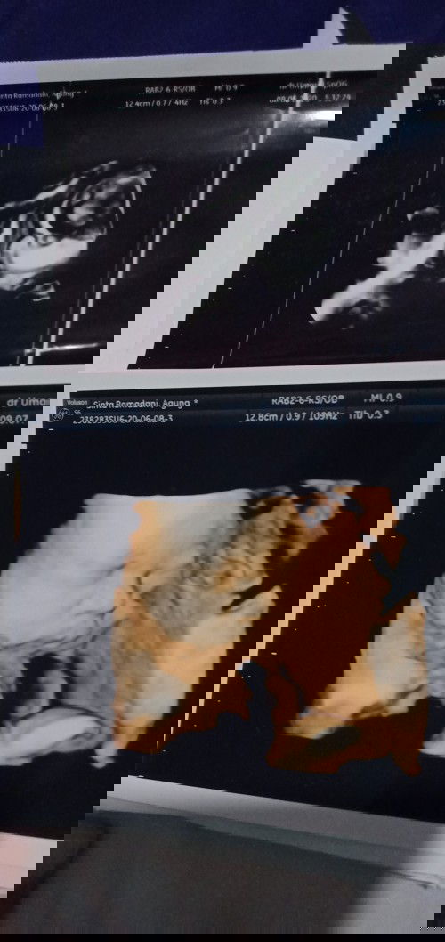 Saran Kelahiran Normal