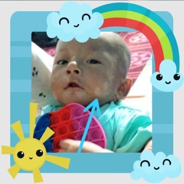 Bunda2 mau tanya donk anak aku muka ya byak putih2 kyak panu tapi dia gak asi tp make sufor....???