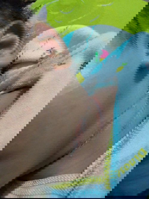 Cara mengeringkan leher bayi yg lecet seperti kulit mengelupas?