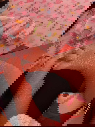 ผิวน้องแห้ง แบบนี้ต้องใช้อะไรจะหายคะ