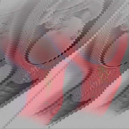 Closed cervix at 40 weeks and 2 days