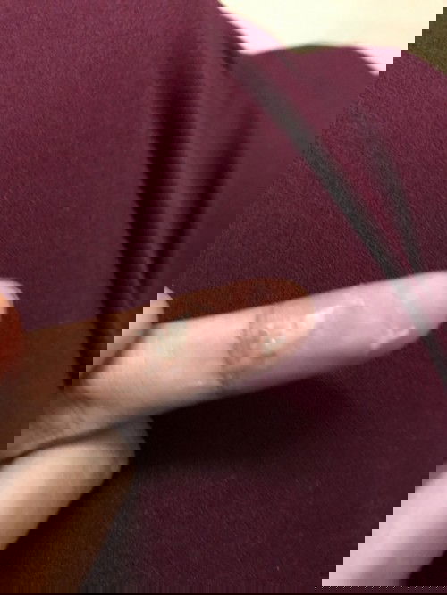 normal ke keputihan mcmni semasa hamil, hamil 12week