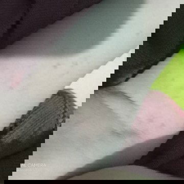 Seputar gatal di kulit