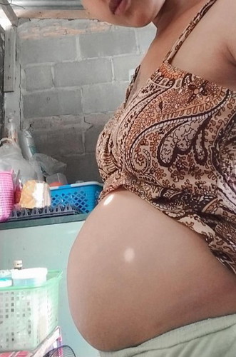 มีแม่ๆคนไหนเป็นเหมือนกันไหม28w แล้วแต่ยังไม่รู้เพศลูกเลย