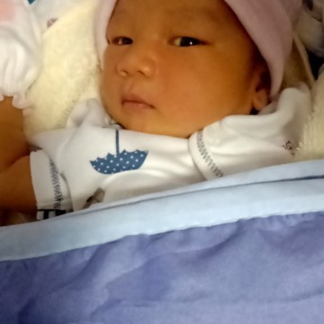 ลูกแม่ๆคนไหนตัวเหลืองหลังออกโรงบาลบ้างค่ะน้องได้14วันแต่น้องยังตัวเหลืองแม่ท่านไหนพอจะมีวิธีบอกหน่อย