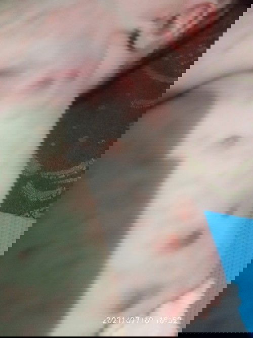 Merah pada kulit bayi