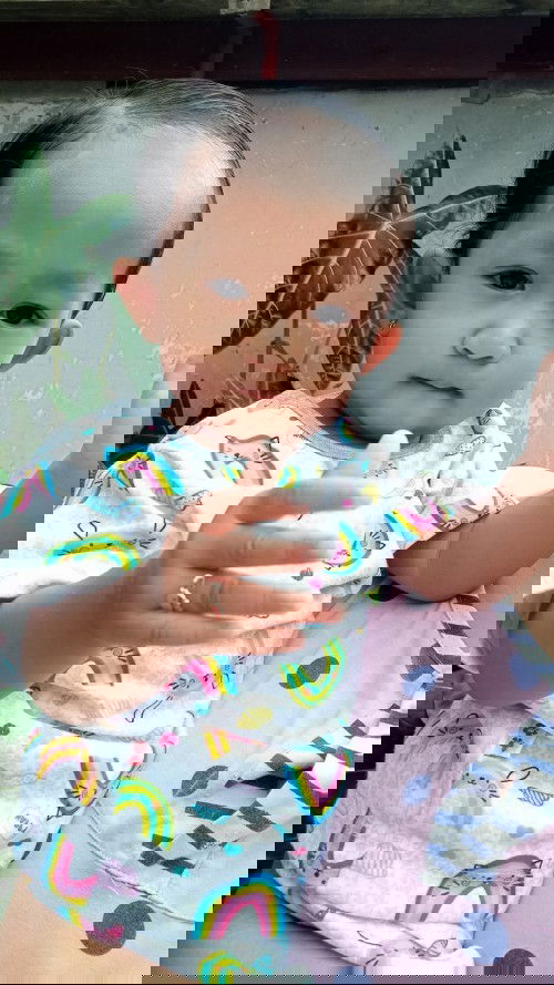 Bercak putih di wajah anak 1thn