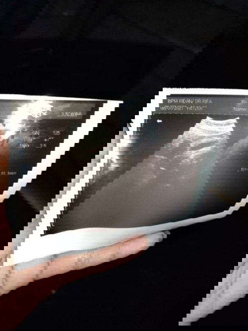 Semangat trs dan Pntng mnyrh