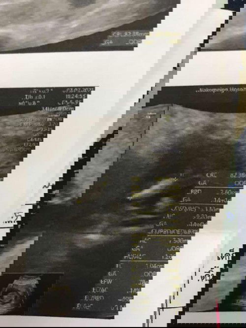 ช/ญ คะดูไม่ออกเลย