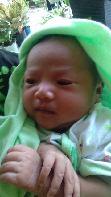 tangan bayi kelupas