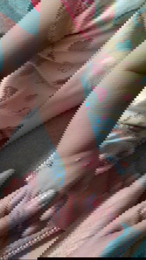 Bintik2 putih di seluruh badan