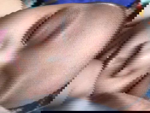 ใช่ผดร้อนไหมคะแม่ๆ