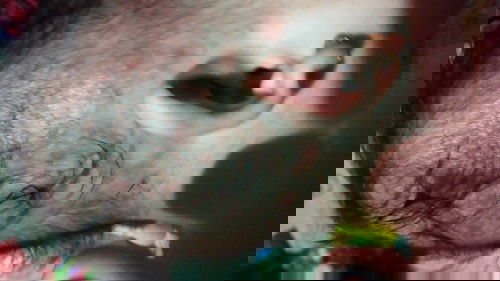 Bintik merah dikepala