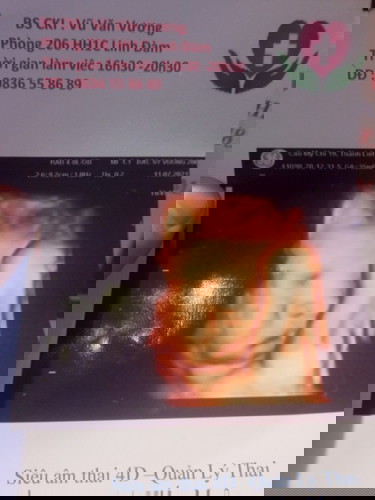 Con em đây mng che mặt đó hí hí , 35 tuần 3kg bác sĩ bảo sanh ra phải 4 cân ý