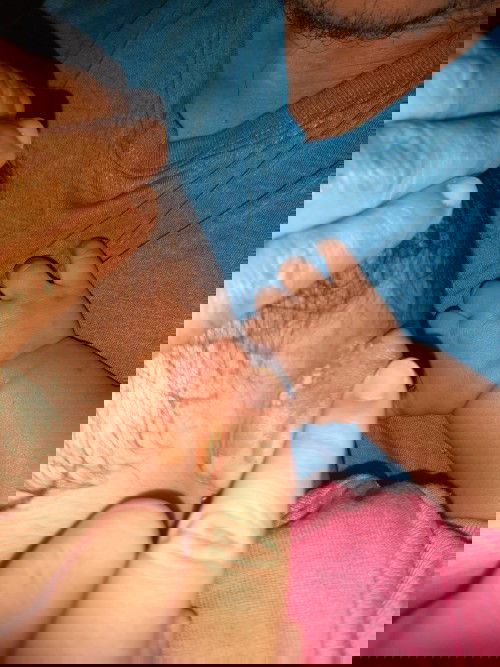 Luka melepuh belakang telinga