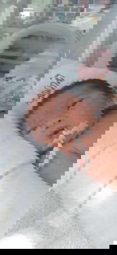 เด็ก preterm ของแม่