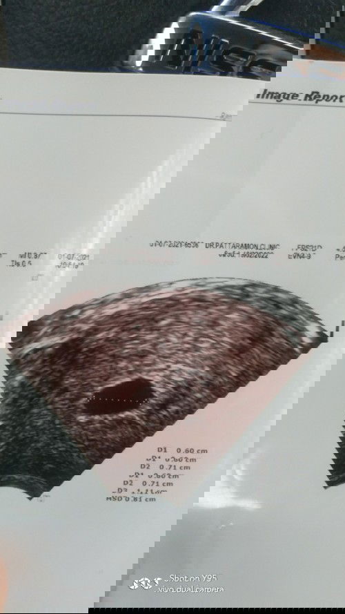 อยากถามแม่ๆหลายๆคนนะคะ