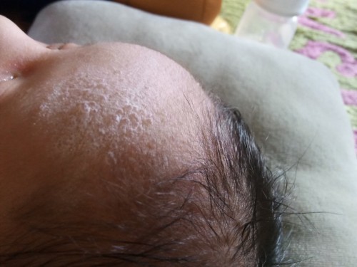 Bunda bunda itu obat nya apa ya bunda²,seperti keringat malam tapi ada banyu nya kasi saran dong bun