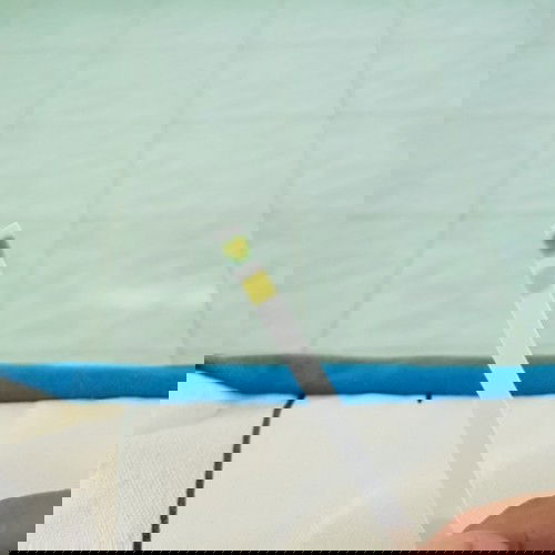 อายุครรภ์ 28 วีค ตรวจเจอน้ำตาลในปัสสาวะ +3