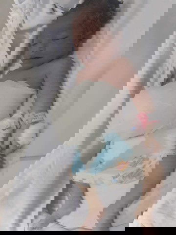 คลอดก่อนกำหนด 36+3