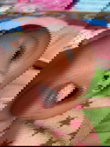 ลิ้นเป็นแบบนี้ ทำยังไงจะหายคะ