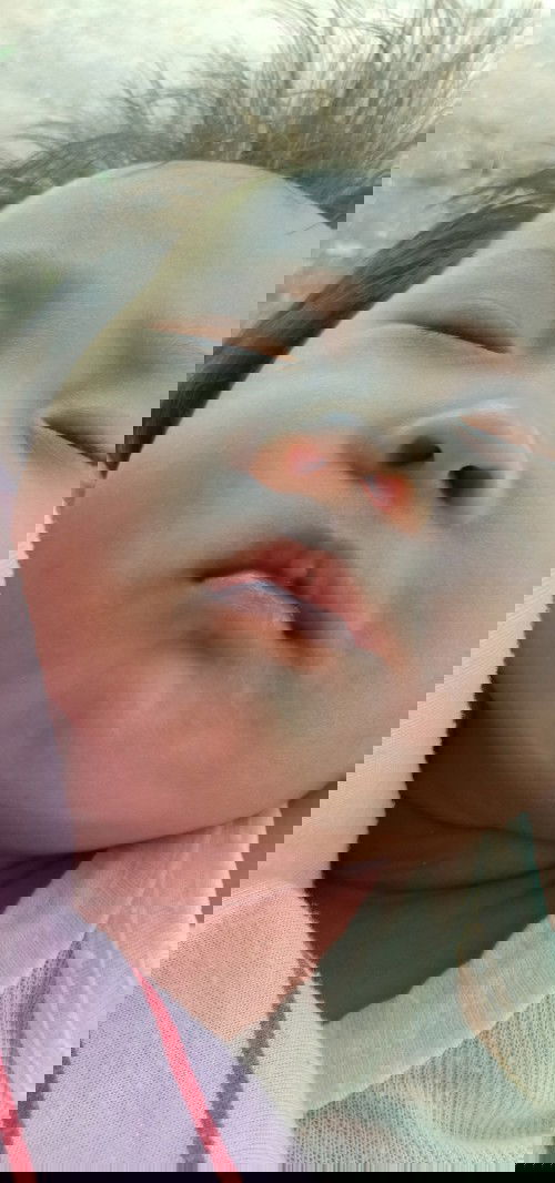 putih putih di wajah bayi