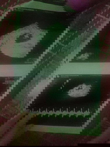 นี้คือตัวเด็กใช่ไหมค่ะสอบถามผู้รู้หน่อยค่ะ