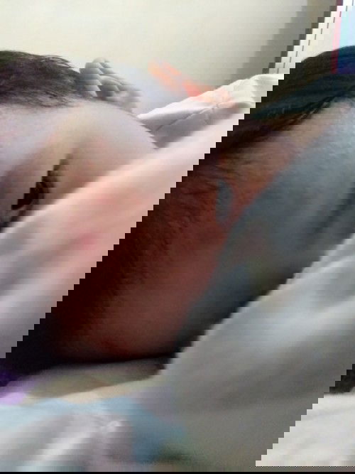 Mengatasi biang keringat