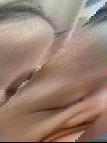 คิ้วลูกหาย??!!